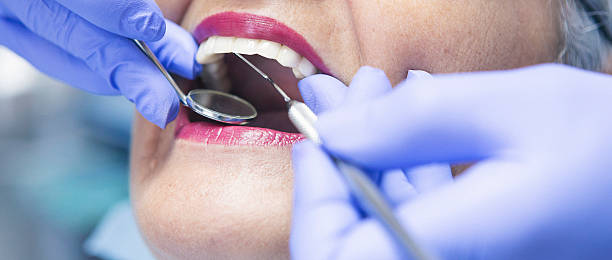 Best Emergency Treatment for Oral Infections in Iola, WI